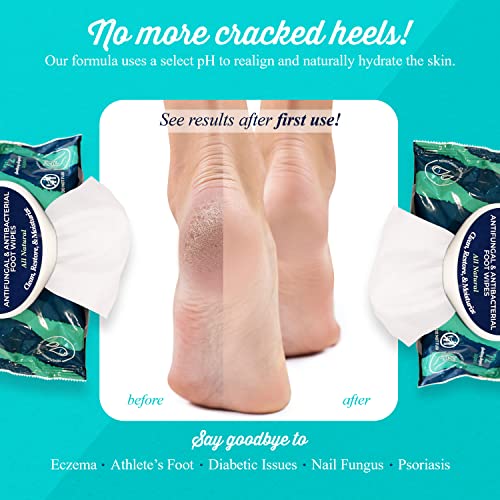 pHeet® Foot Wipes - All-Natural Antifungal & Antibacterial Formula, view 4